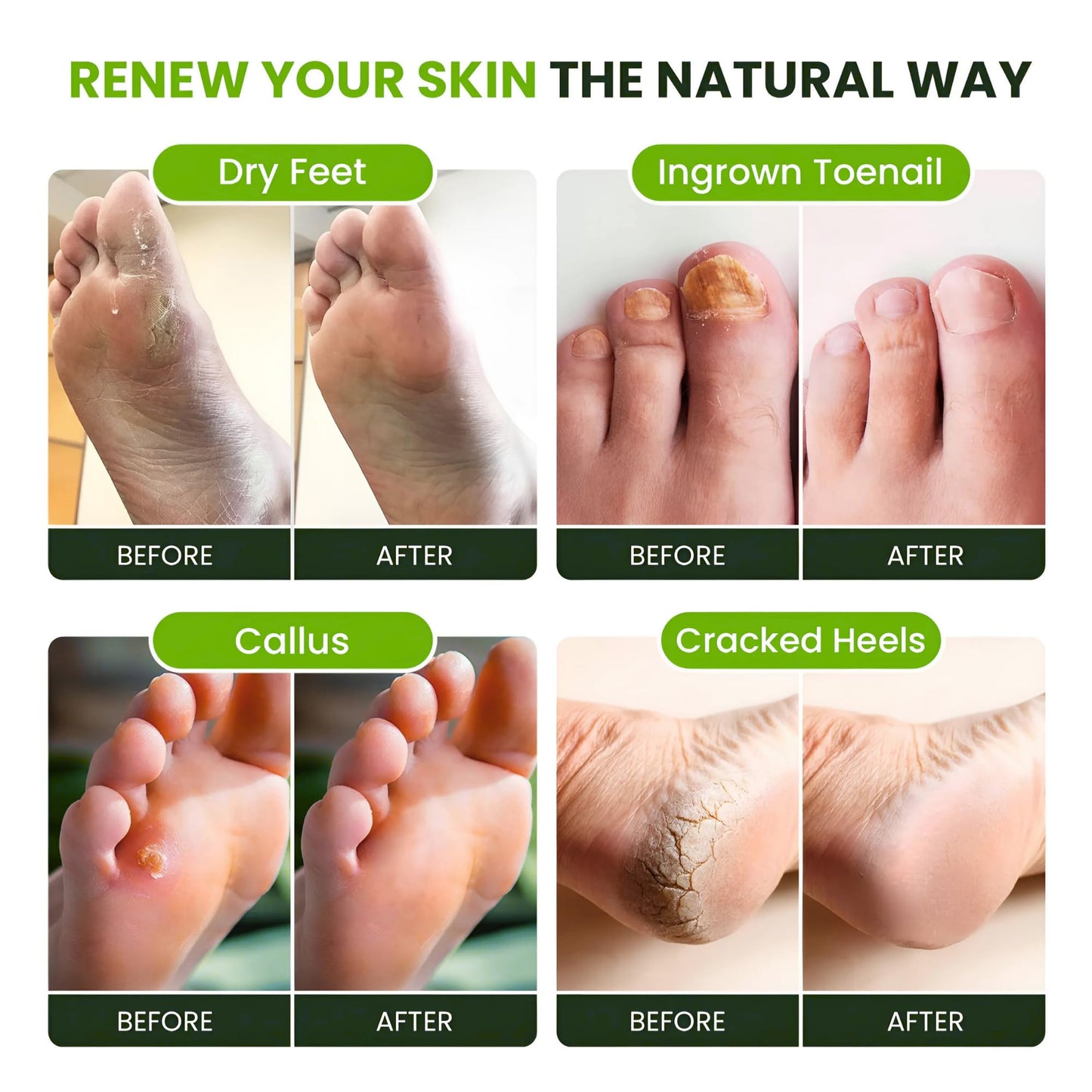 Foot Cure tea tree and eucalyptus essential oil blend for stubborn odor control