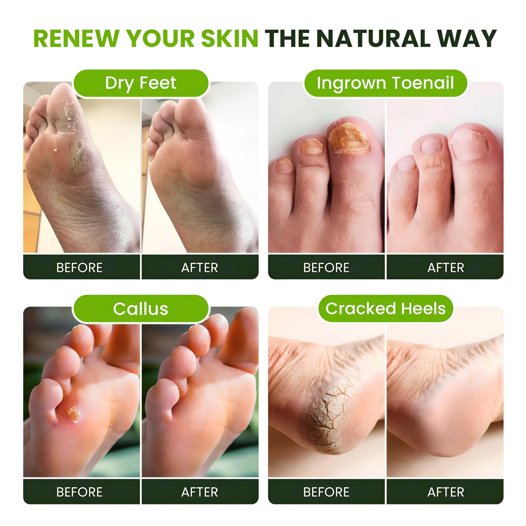 Foot Cure tea tree and eucalyptus essential oil blend for stubborn odor control