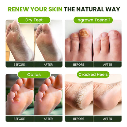 Foot Cure tea tree and eucalyptus essential oil blend for stubborn odor control