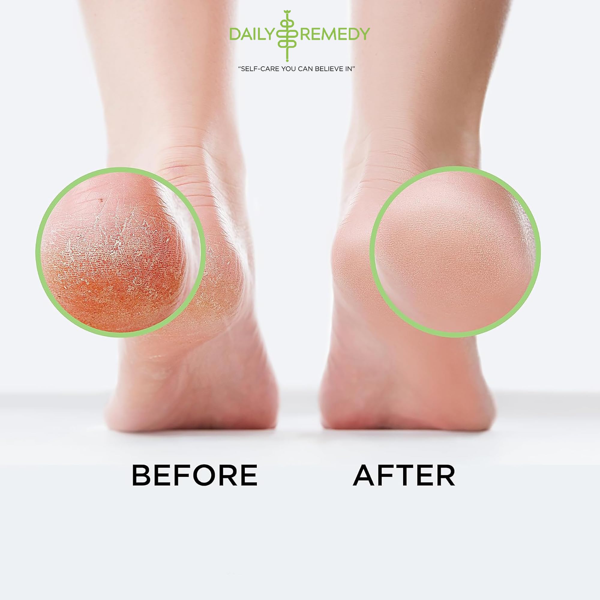 Daily Remedy foot soak product dimensions and sixteen ounce weight verification label