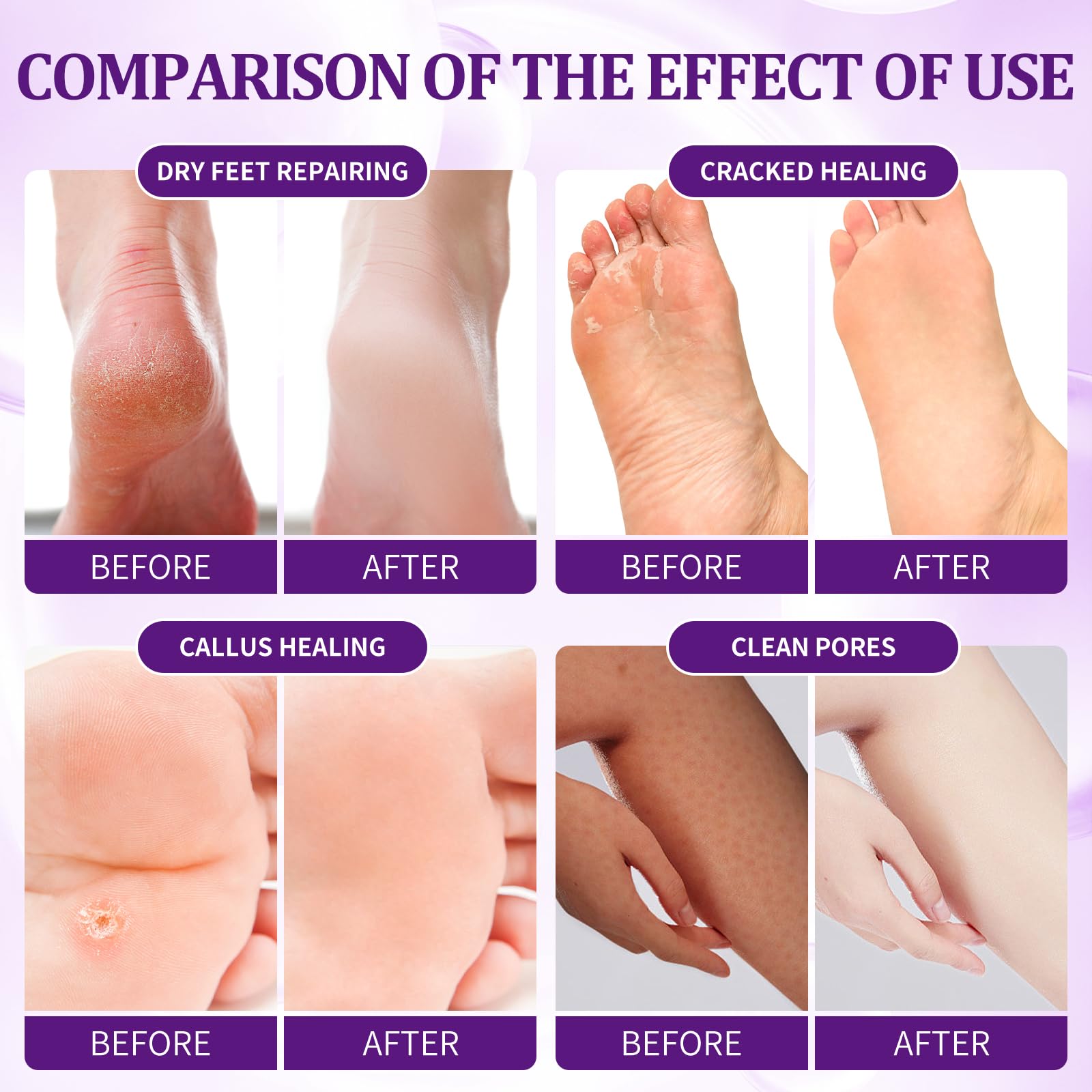 4 step foot treatment bubble salt sachet