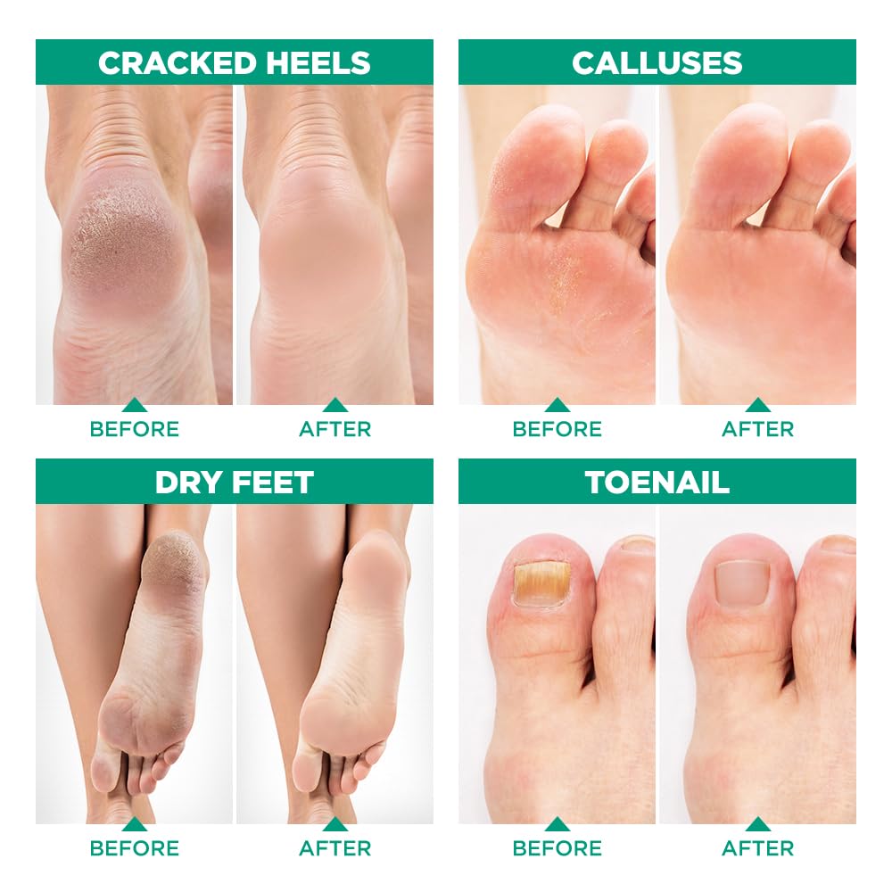 Soothing foot bath with Epsom salt and tea tree oil