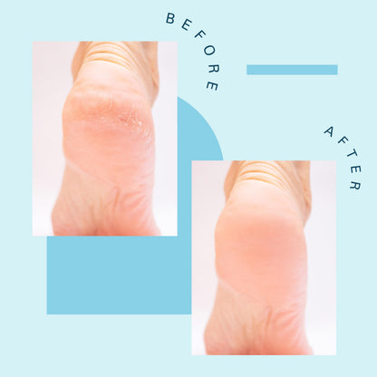 Healthy toenail and detox foot spa therapeutic crystals package perspective