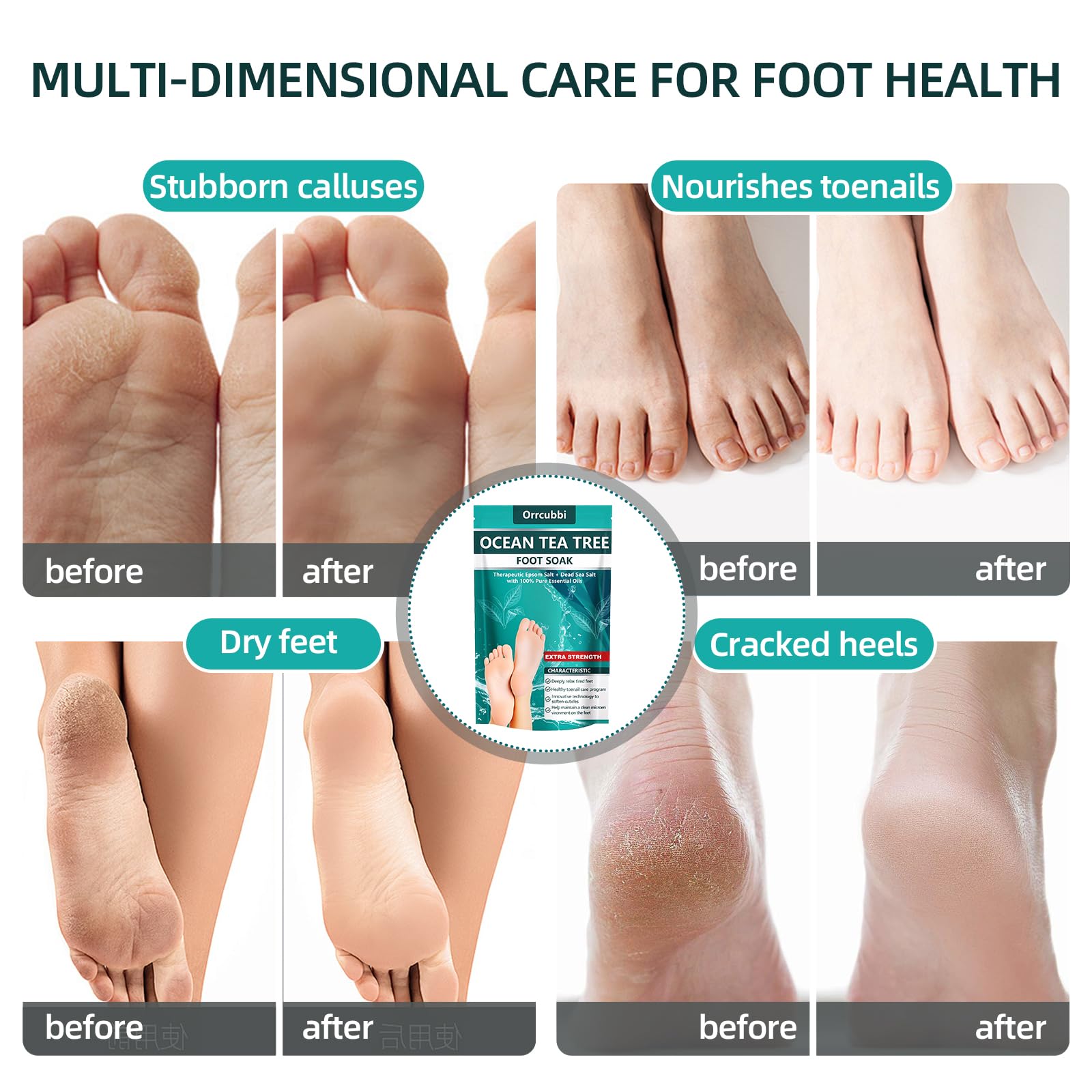 Hand holding Foot Cure tea tree oil foot soak packaging
