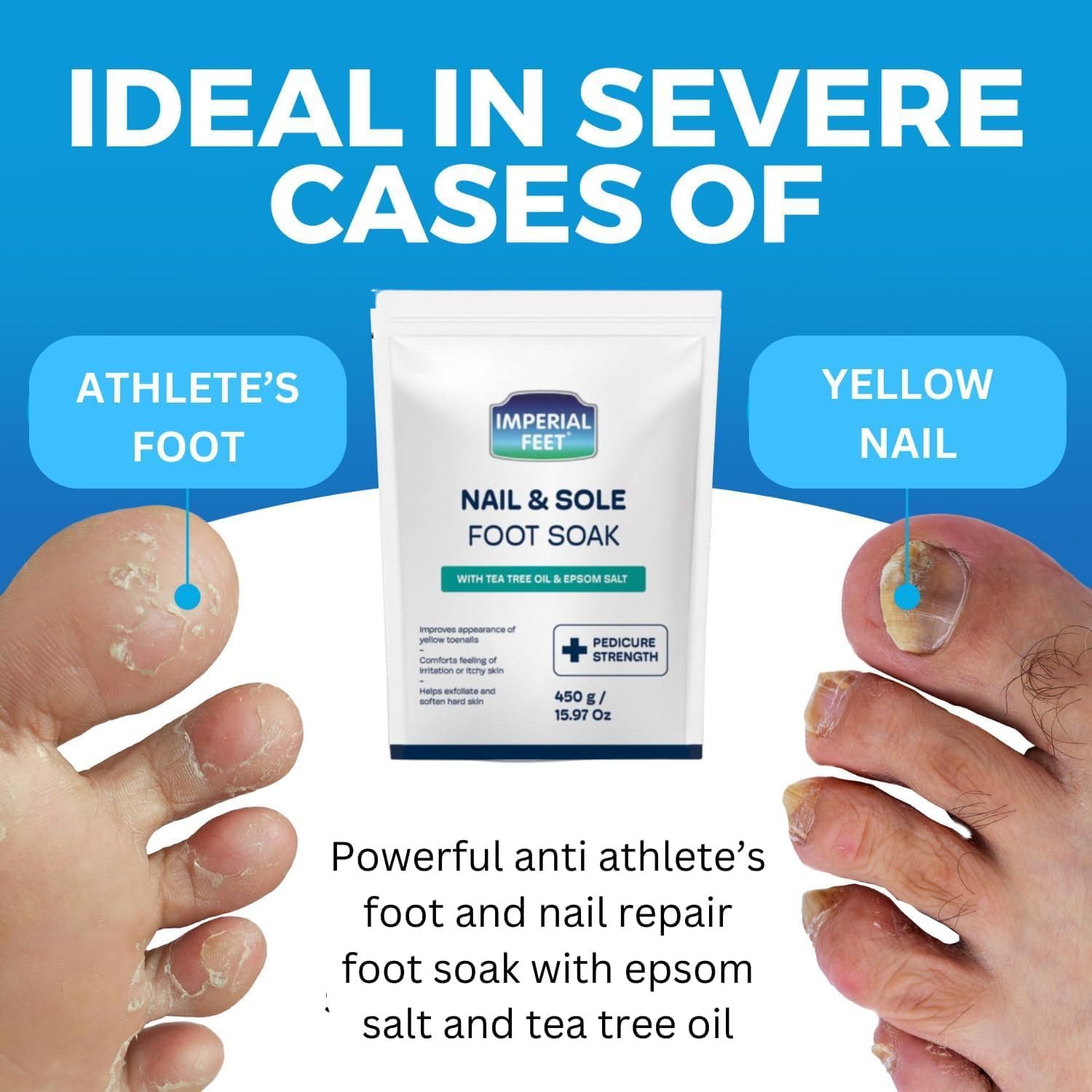 Tea tree oil and Epsom salt foot bath ingredients display
