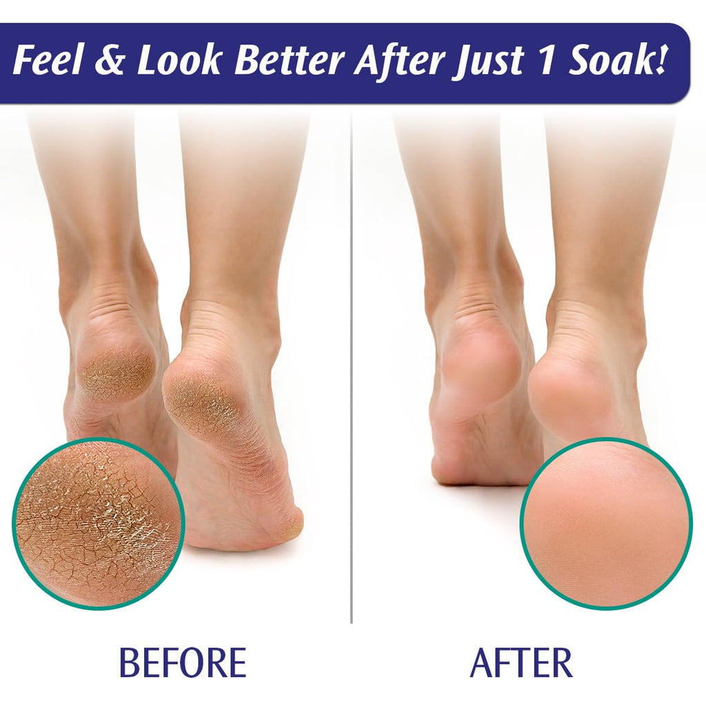 Pedifix Epsom salt foot soak box back label information