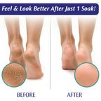 Pedifix Epsom salt foot soak box back label information