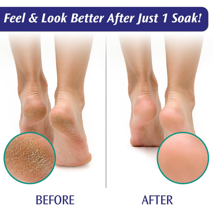 Close up of PediFix foot care packaging text detailing calluses and corn softening benefits