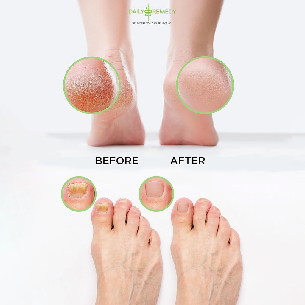Daily Remedy tea tree oil foot soak label view