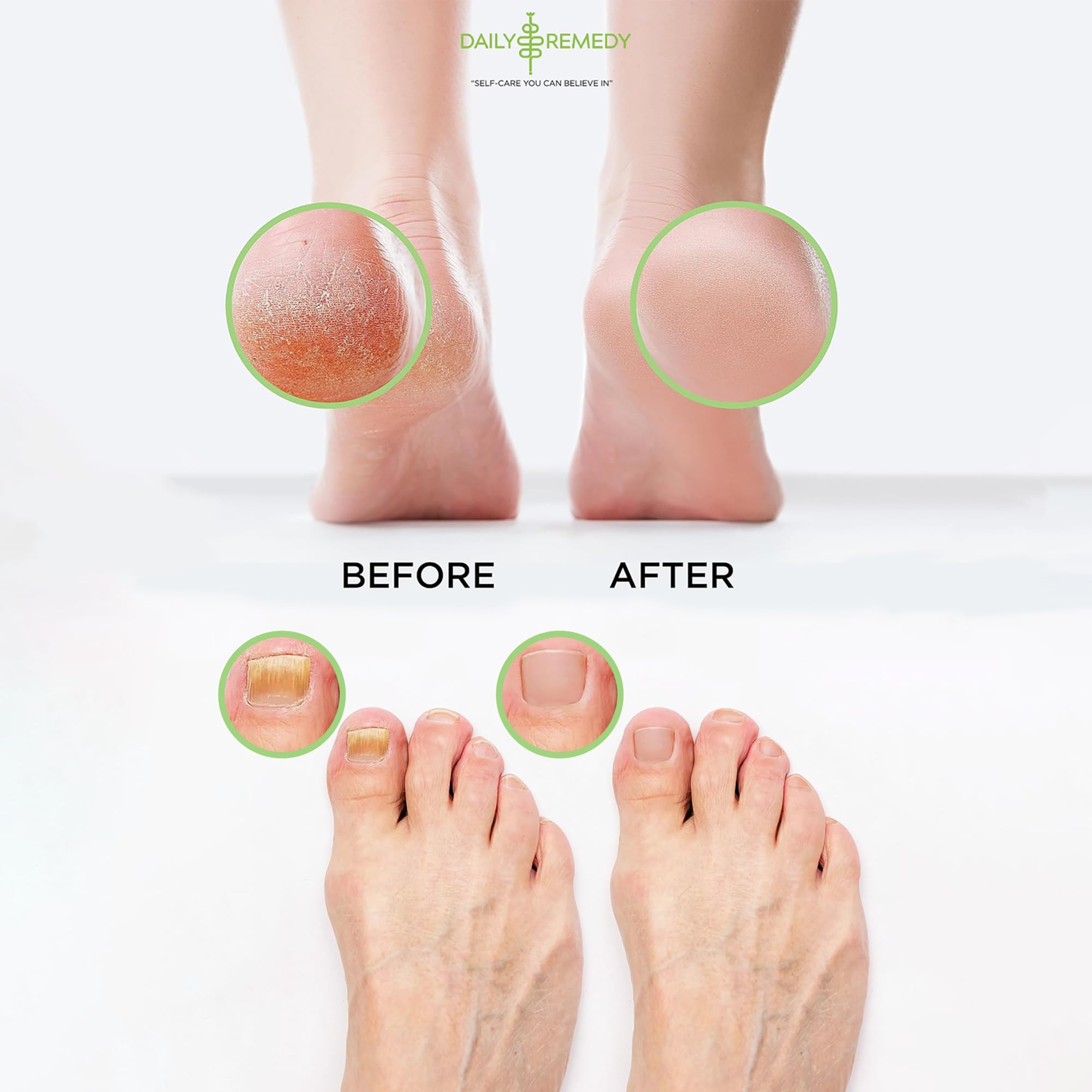 Daily Remedy Citrus Detox clarifying salt crystals for cracked skin