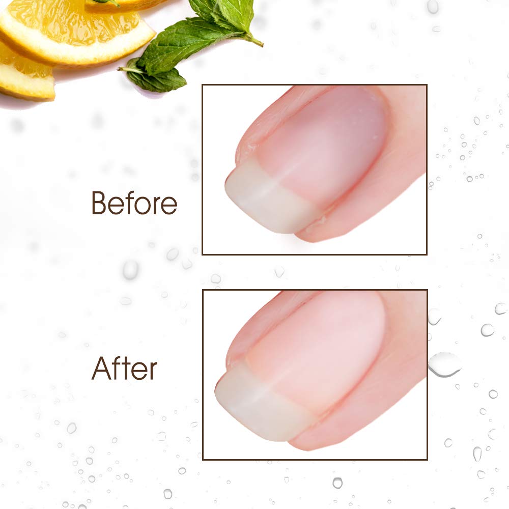 Using the included damp brush to scrub underneath discolored nails
