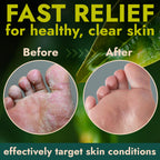 Jar of foot callus remover open to show the creamy exfoliating texture