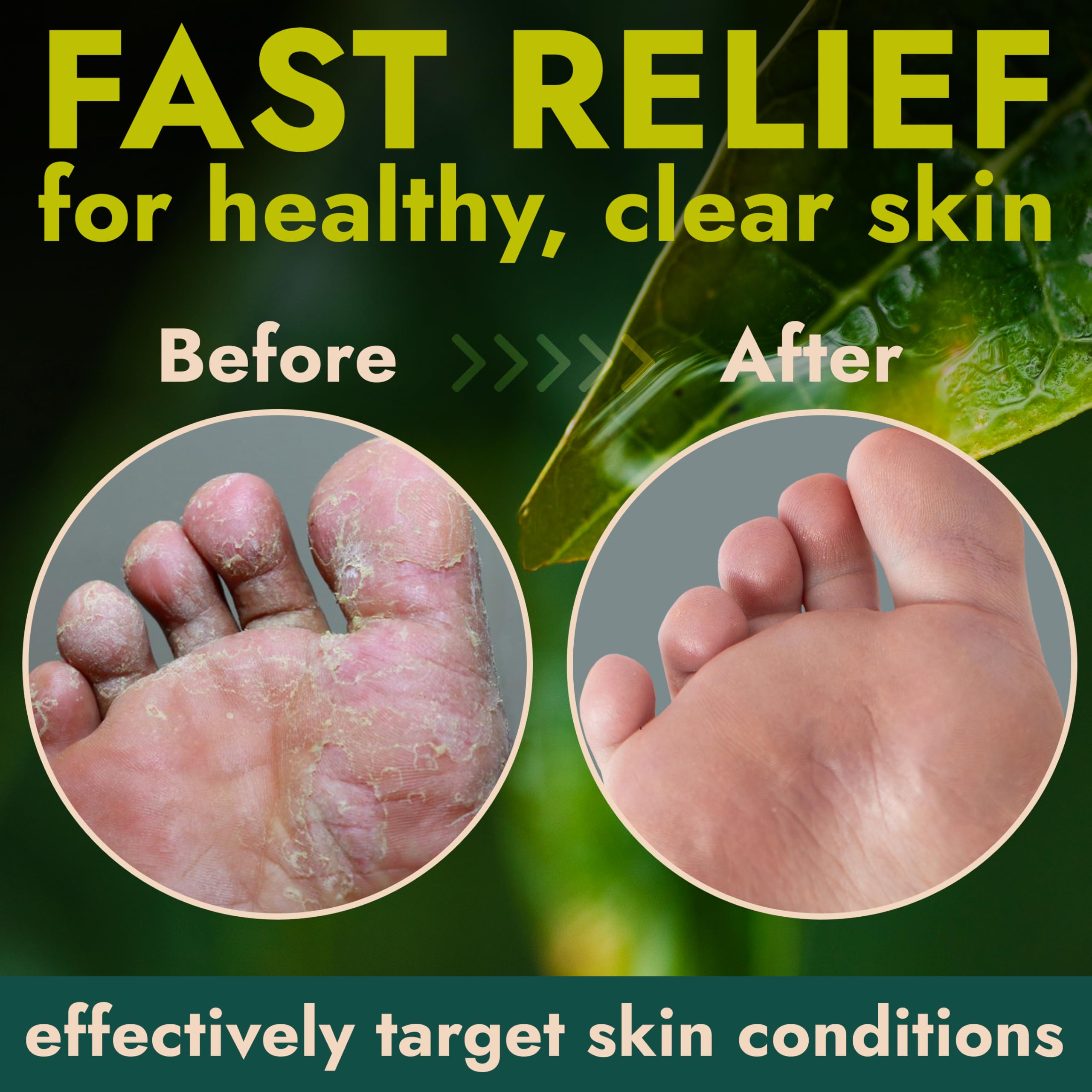 Terramed Just Think Comfort foot care product range