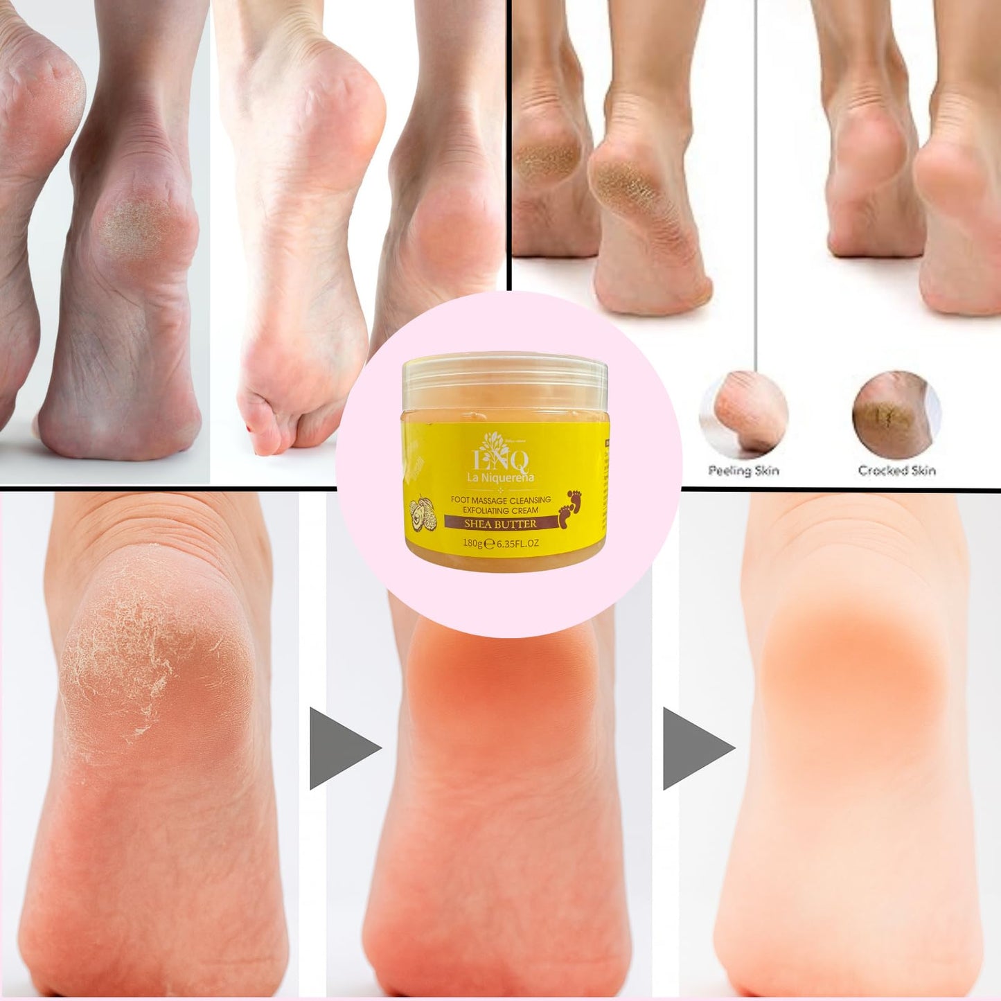 Foot exfoliating gel being applied to cracked heels