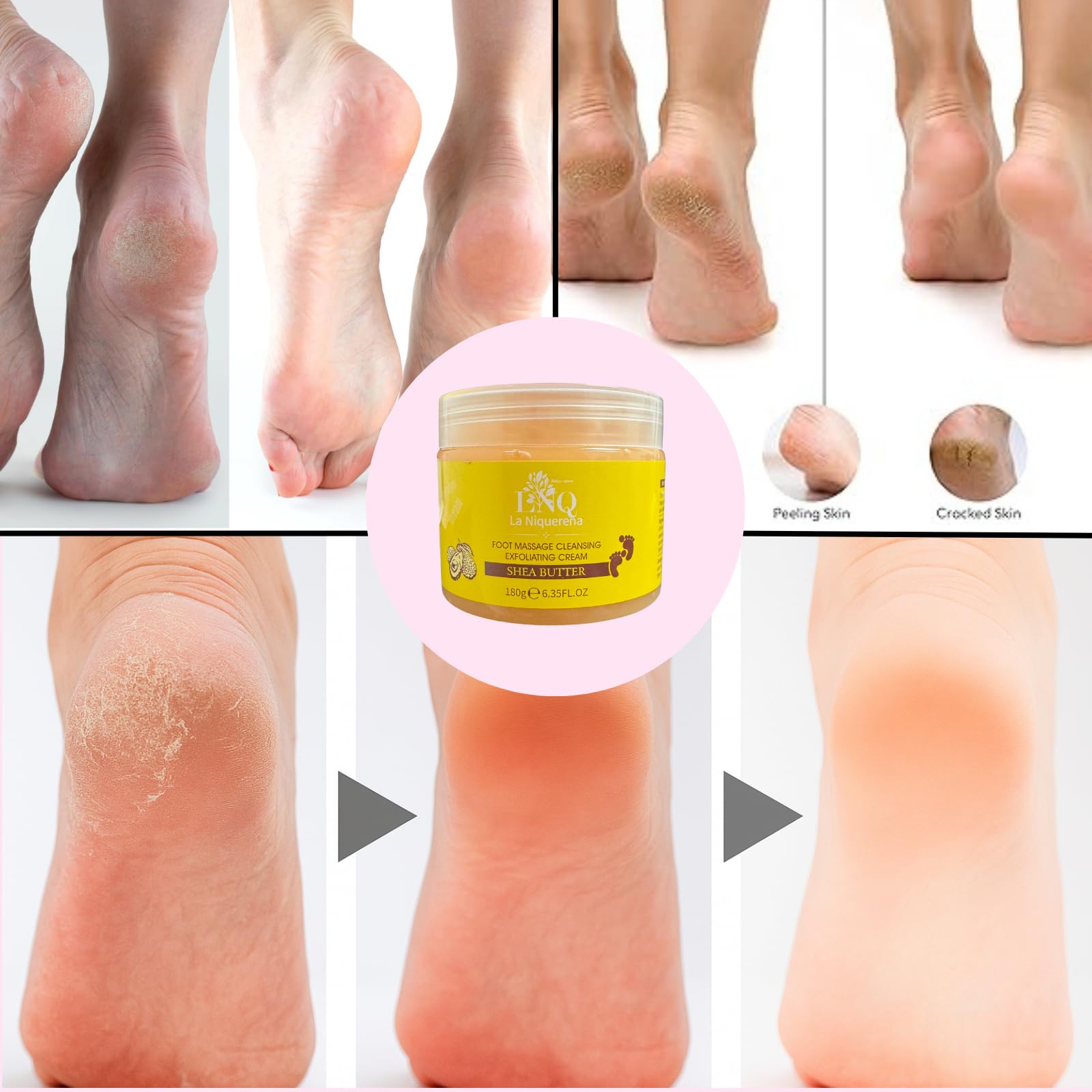 Foot exfoliating gel being applied to cracked heels