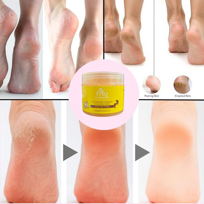 Foot exfoliating gel being applied to cracked heels
