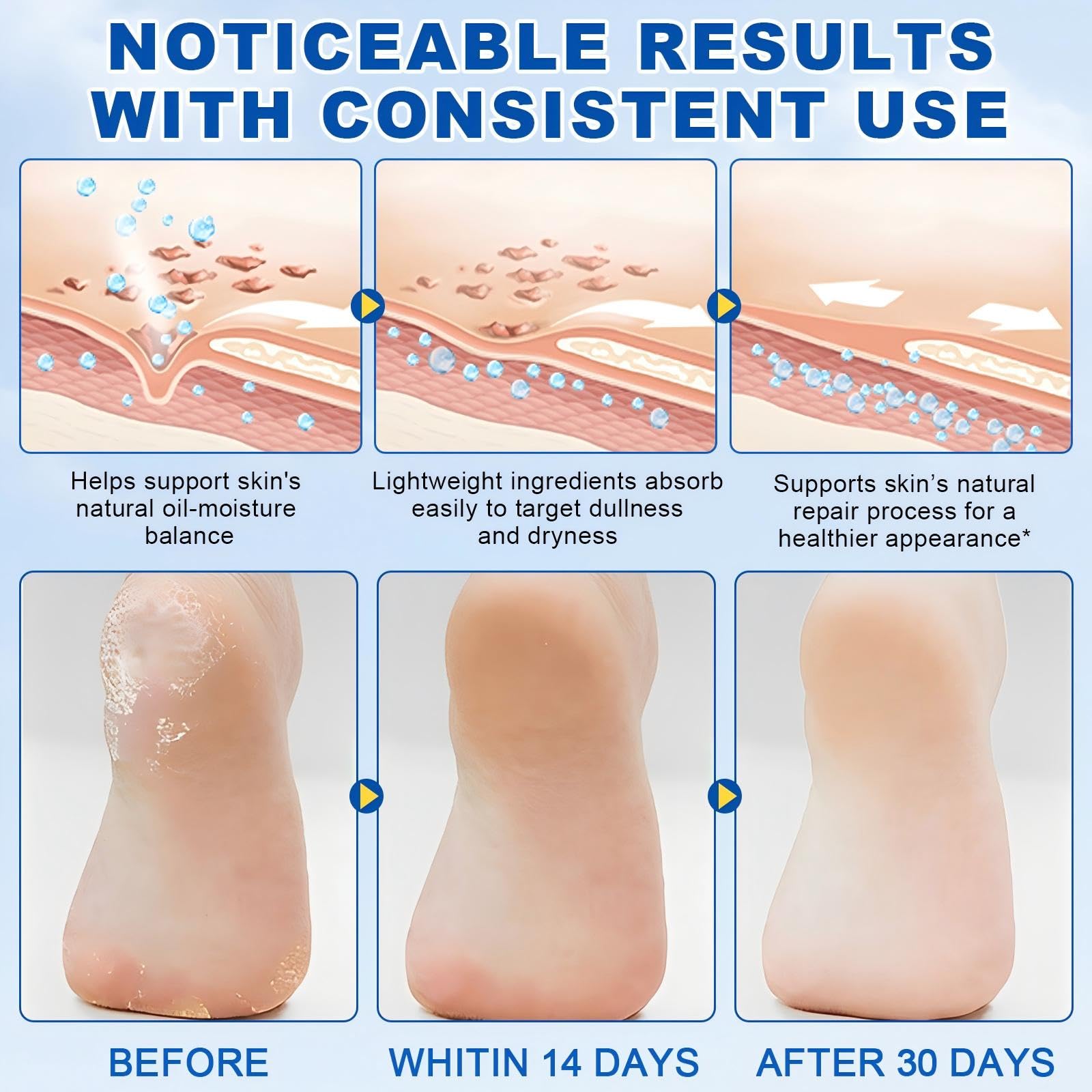 Close up of Yueplattnmay callus remover stick texture
