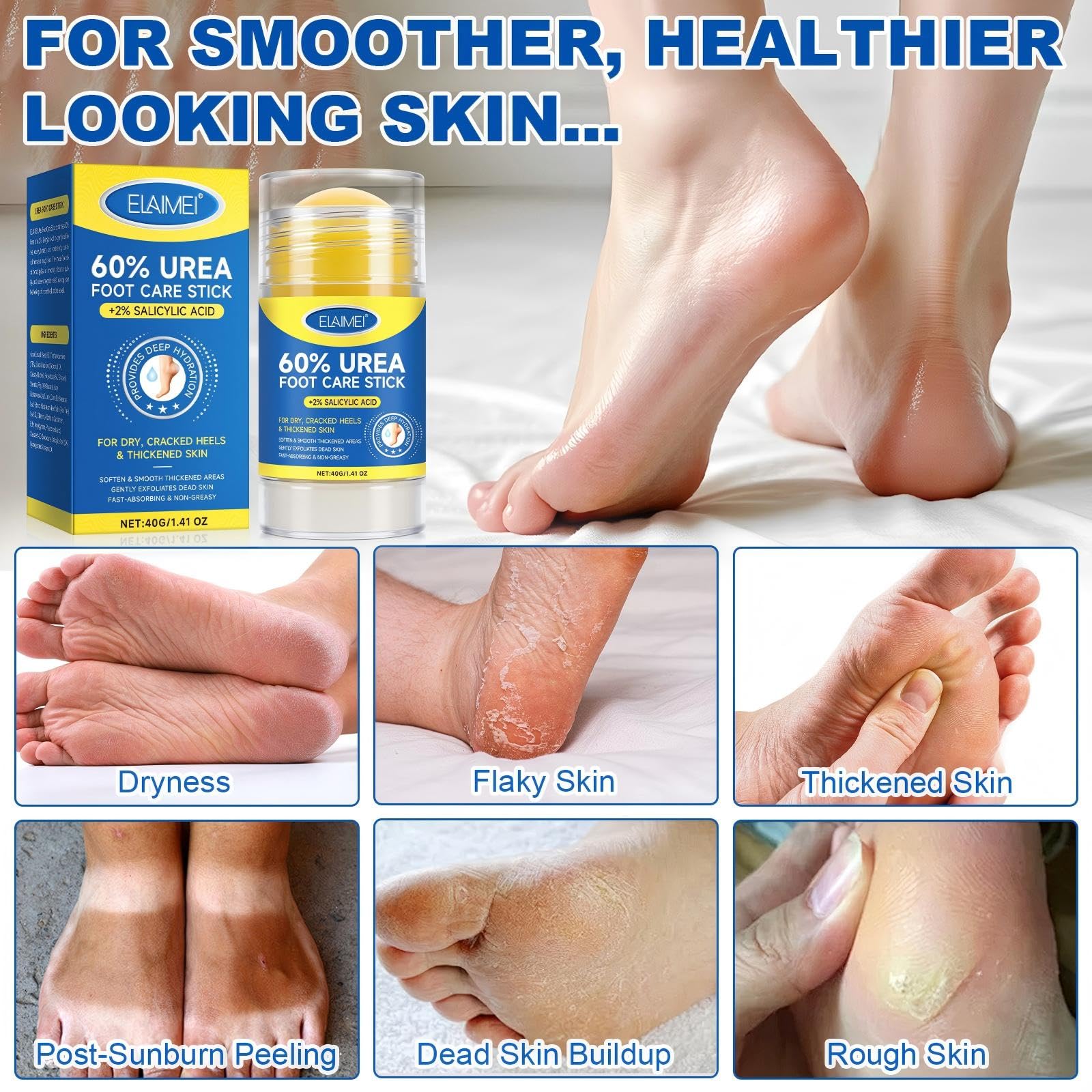 Two pieces of Yueplattnmay urea salicylic acid treatment stick