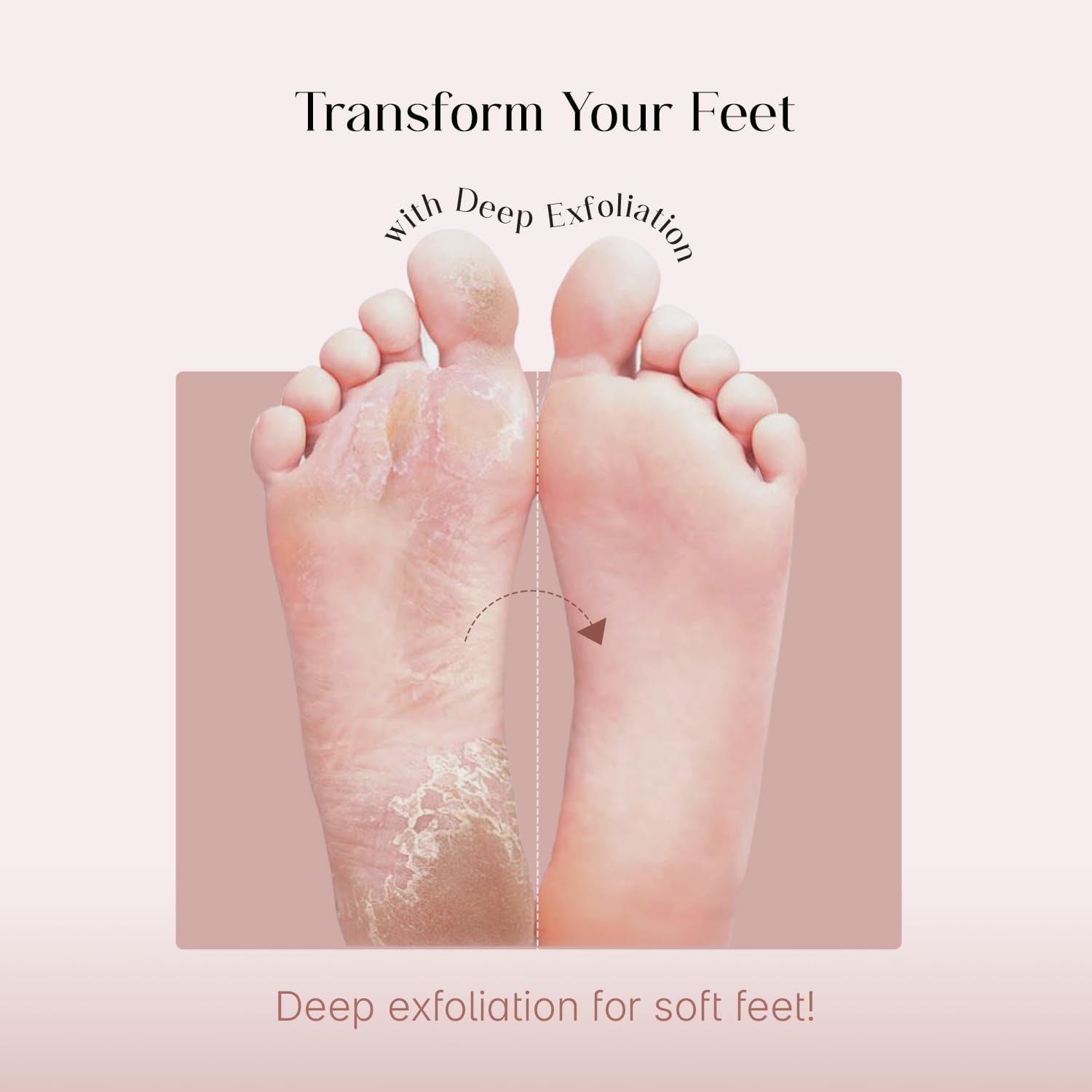 Seoulskin exfoliating foot mask pack for cracked heels