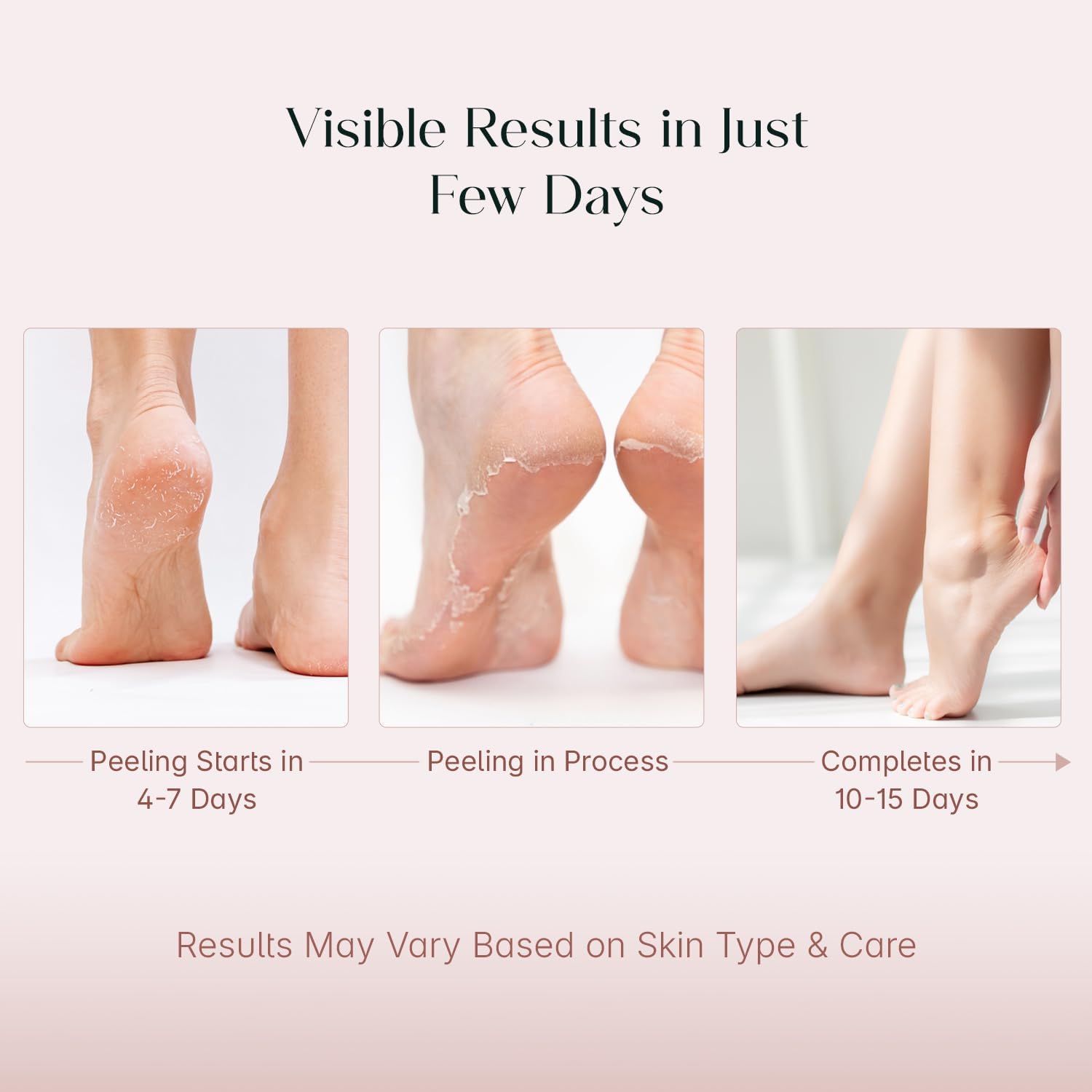 Close up of Seoulskin foot peel off mask packaging