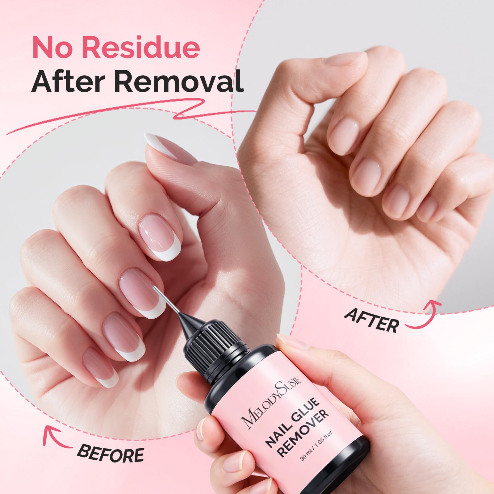 Lifestyle shot of MelodySusie nail glue remover with press on nail kit
