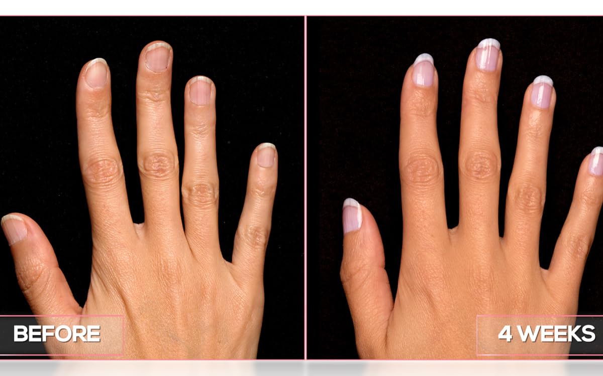 Perfect Formula nail treatment bottle side profile