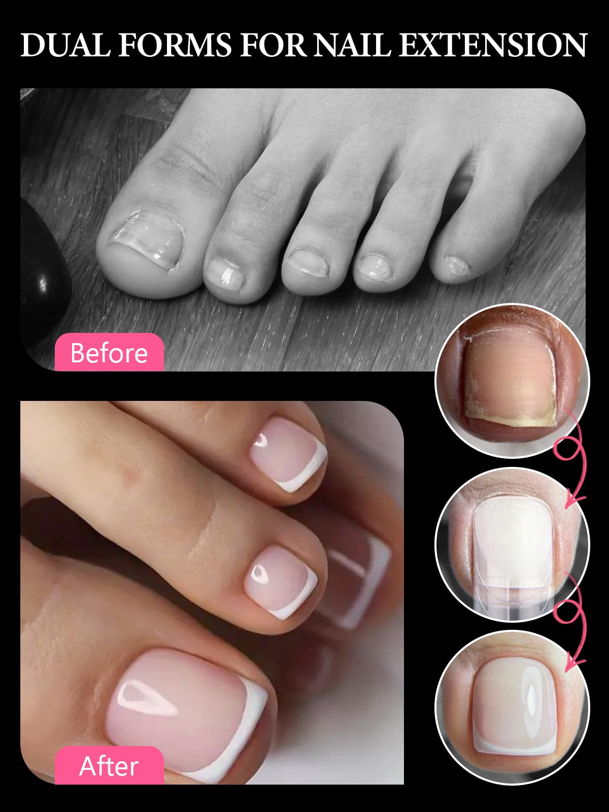 Assorted sizes of reusable toenail extension molds