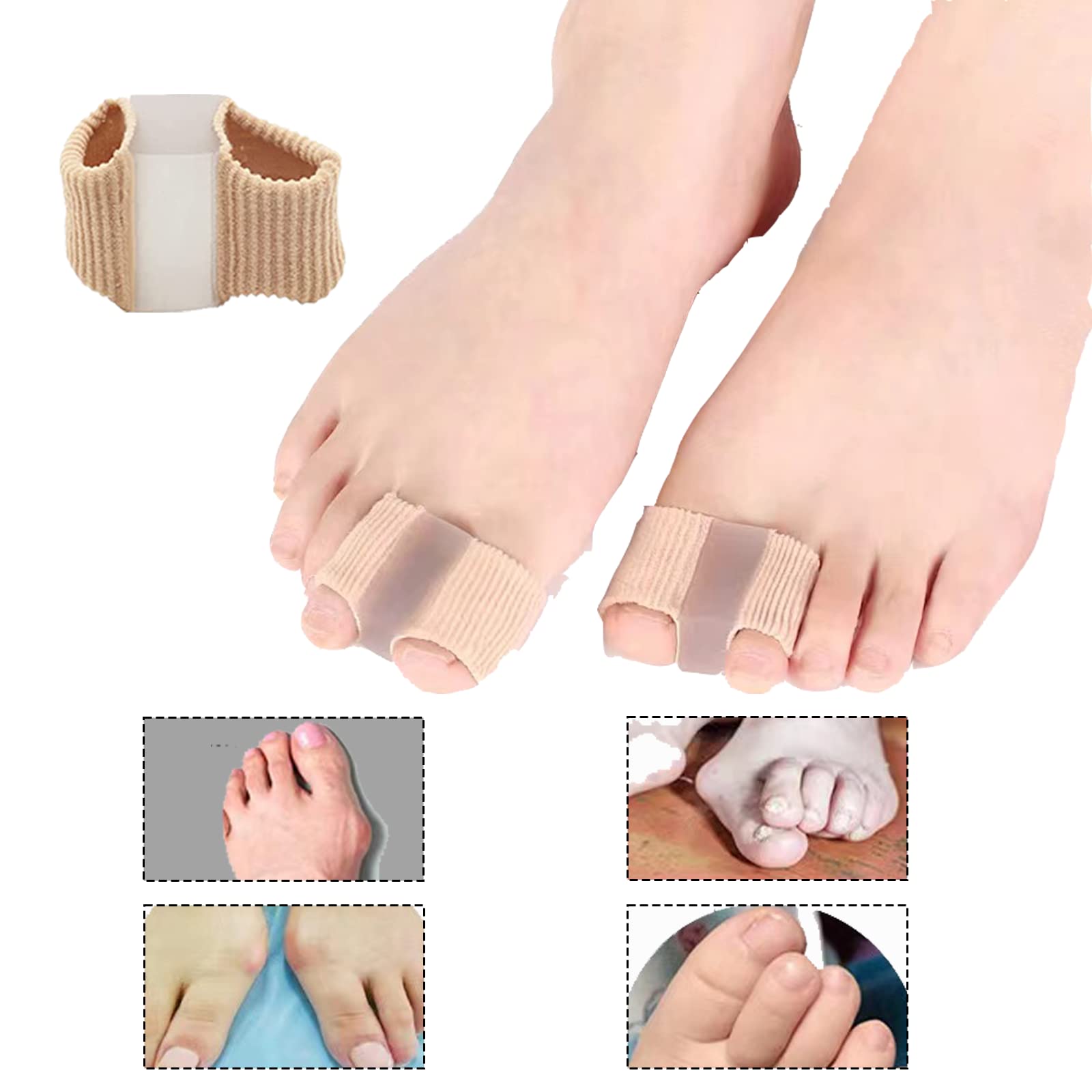 Whycalon breathable bunion corrector on foot