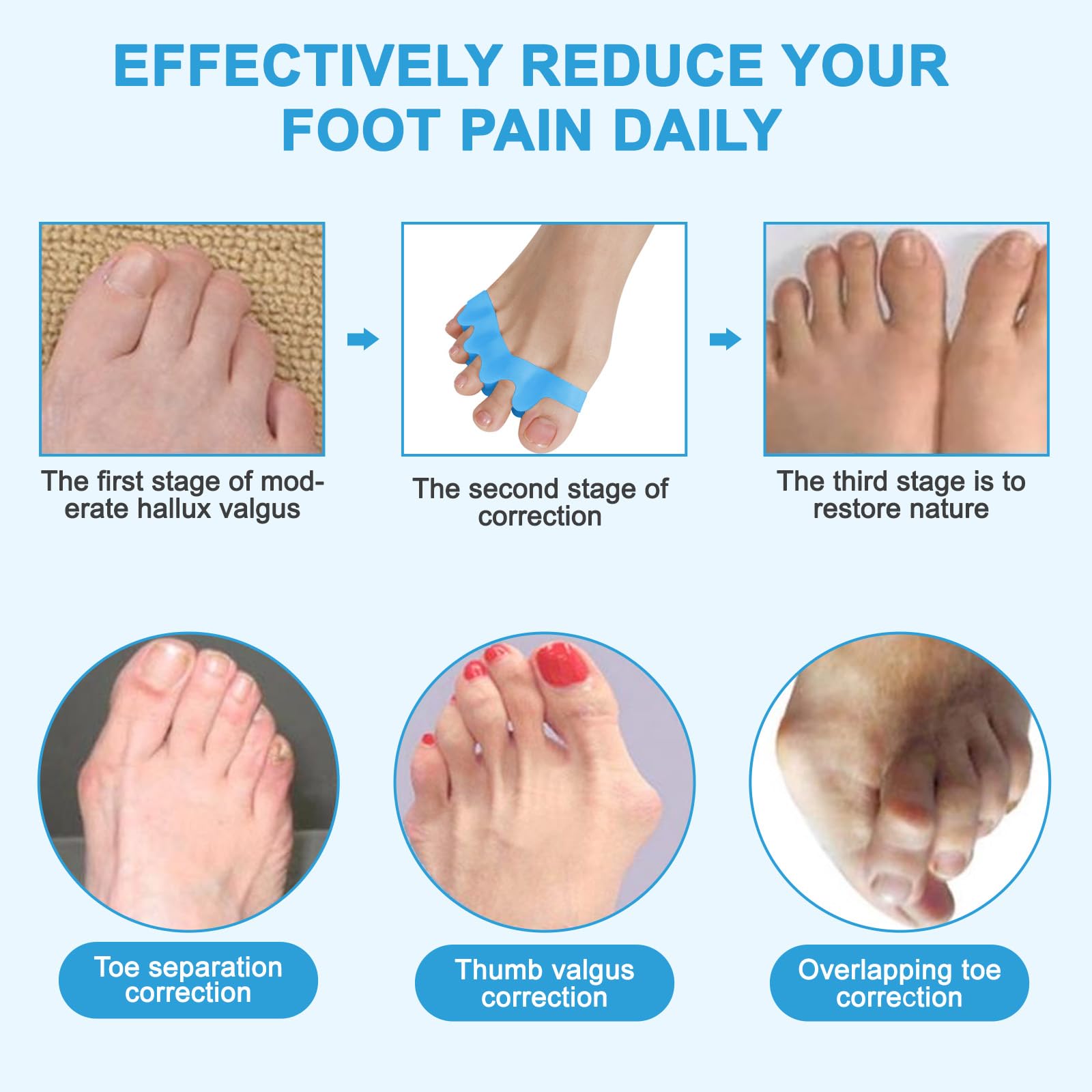 IUFQOZG Bunion Corrector Spacers For Foot Alignment