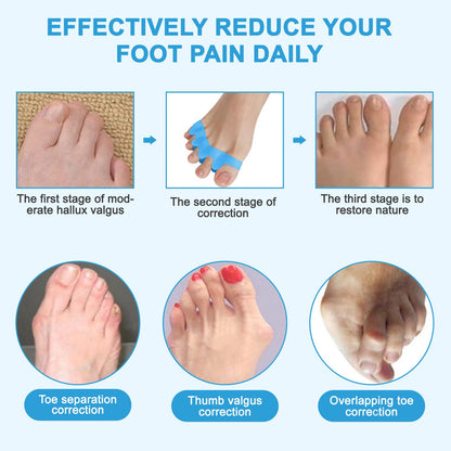IUFQOZG Bunion Corrector Spacers For Foot Alignment