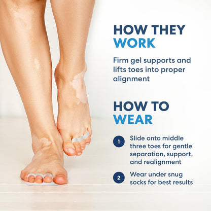 Side profile of hammer toe corrector gel