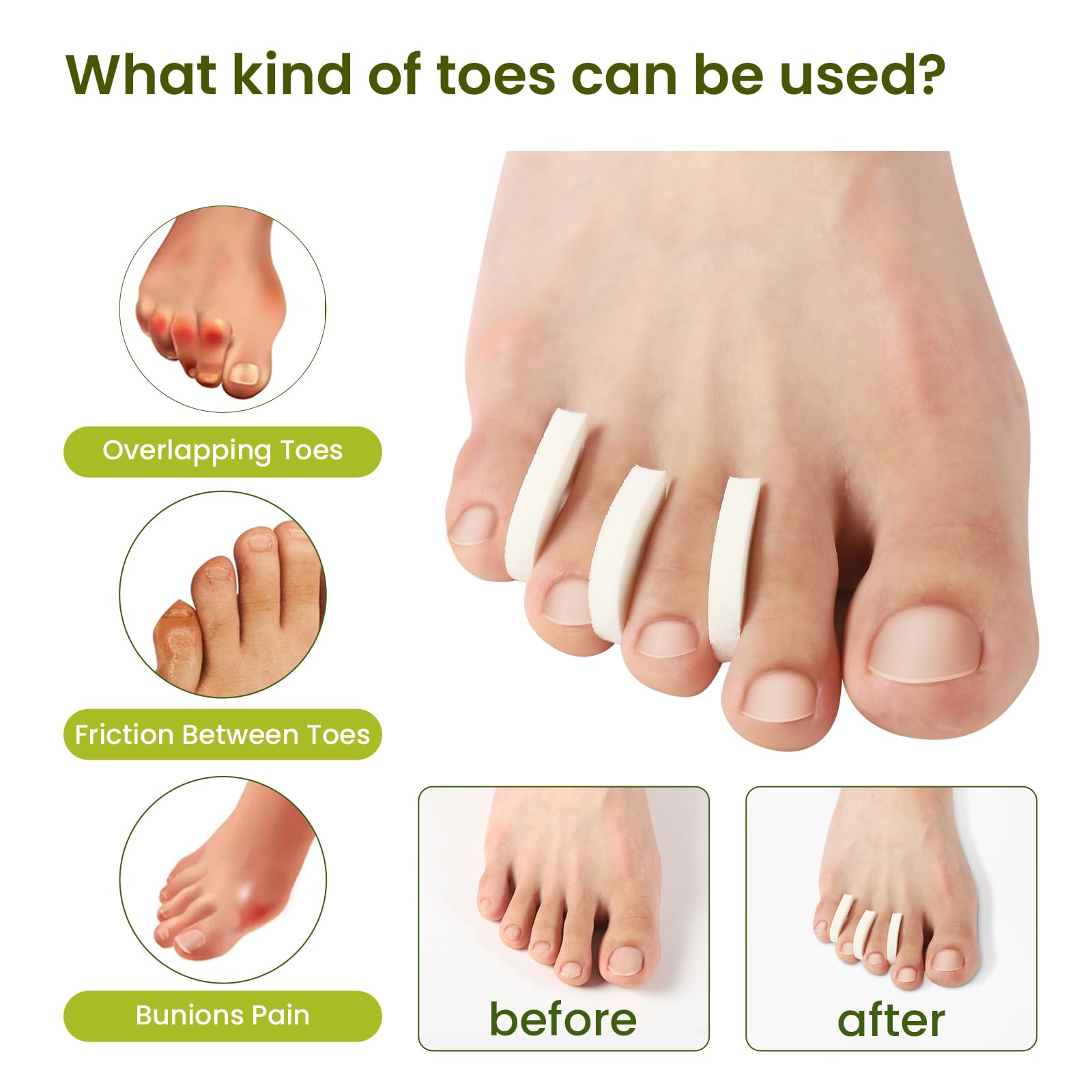 Soft breathable foam material of Bukihome toe correctors