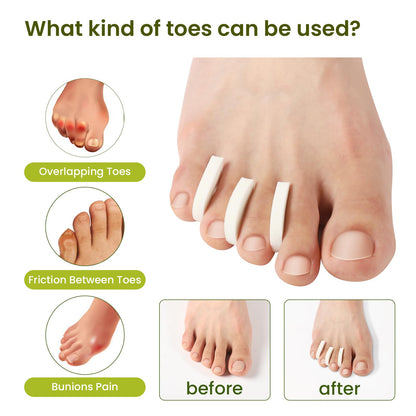 Soft breathable foam material of Bukihome toe correctors