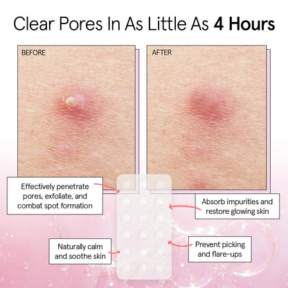 Dermatologist tested vegan pimple patches in packaging