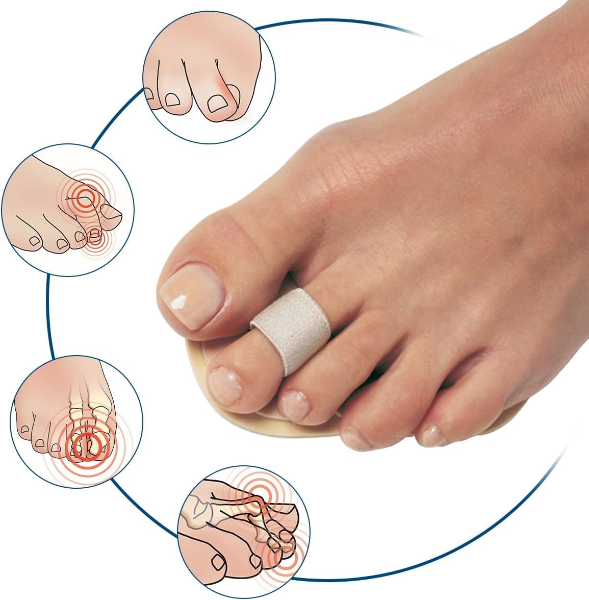 Pedifix toe straightener for overlapping toes
