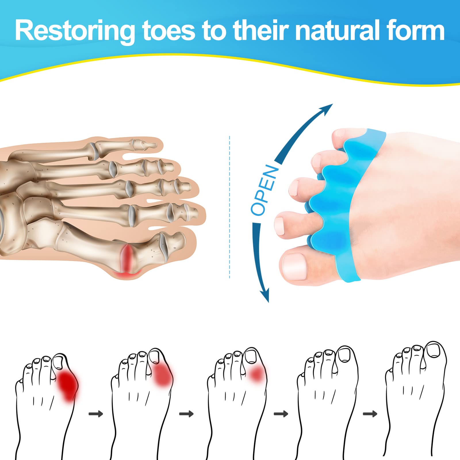 Juzure silicone toe spacers applied between toes for bunion relief