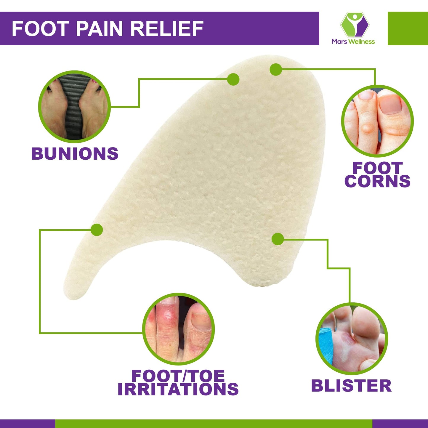 Foam toe spacers for hammer toe and bunion relief