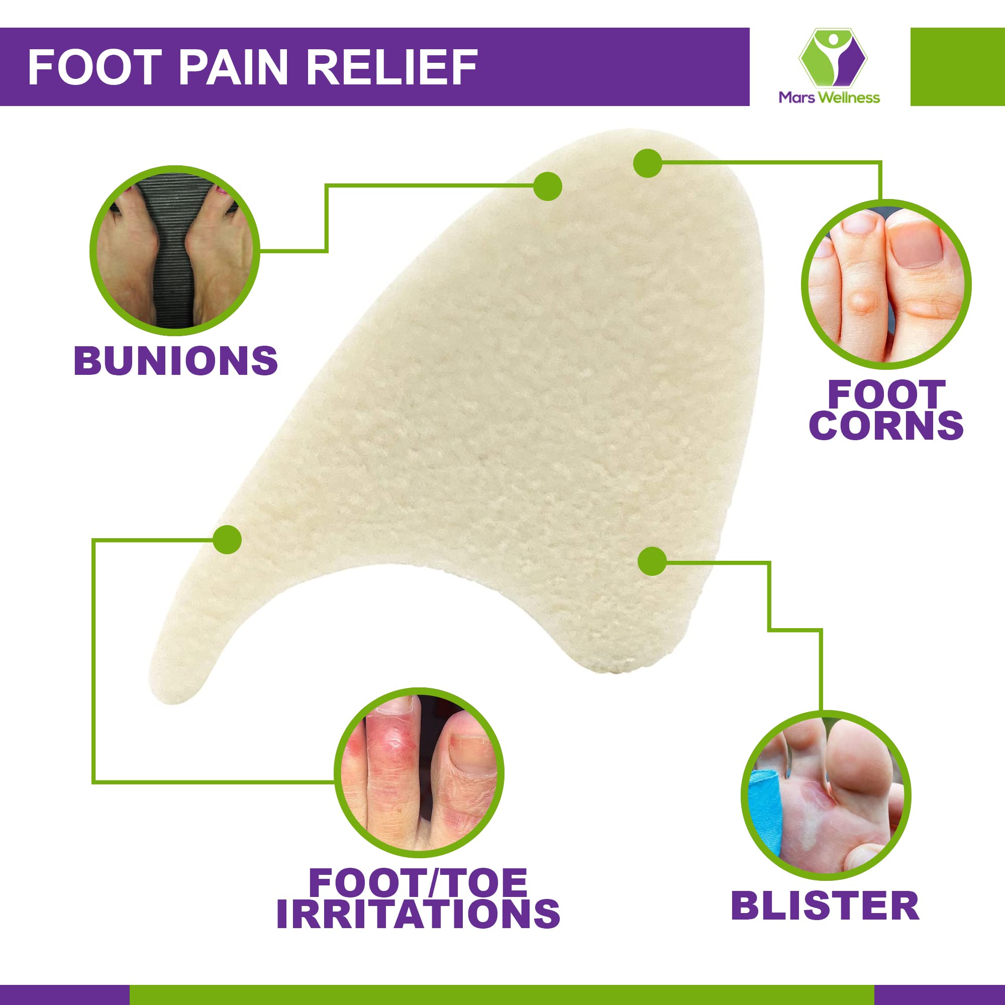 Foam toe spacers for hammer toe and bunion relief