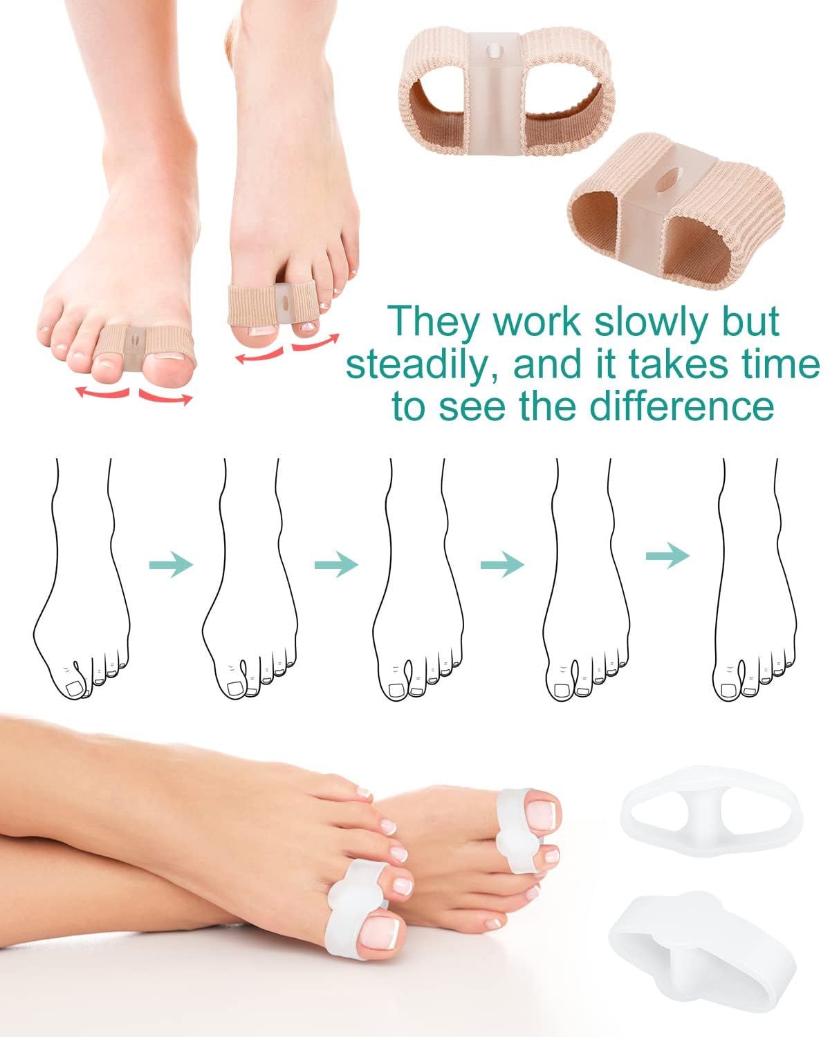 Blatown orthopedic toe separators for comfortable daily wear