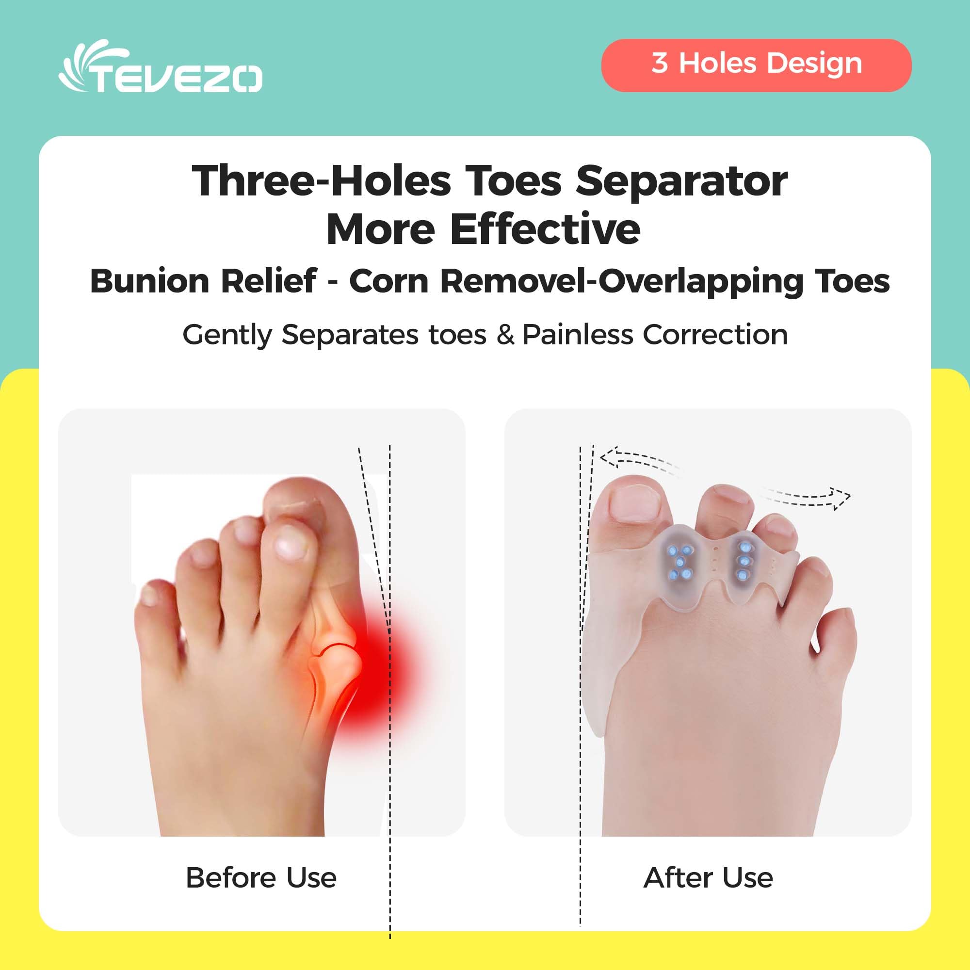 Tevezo bunion relief tool for children showing ergonomic design
