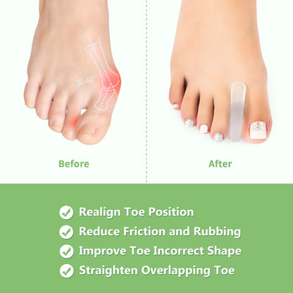 Medical grade silicone bunion corrector for men and women