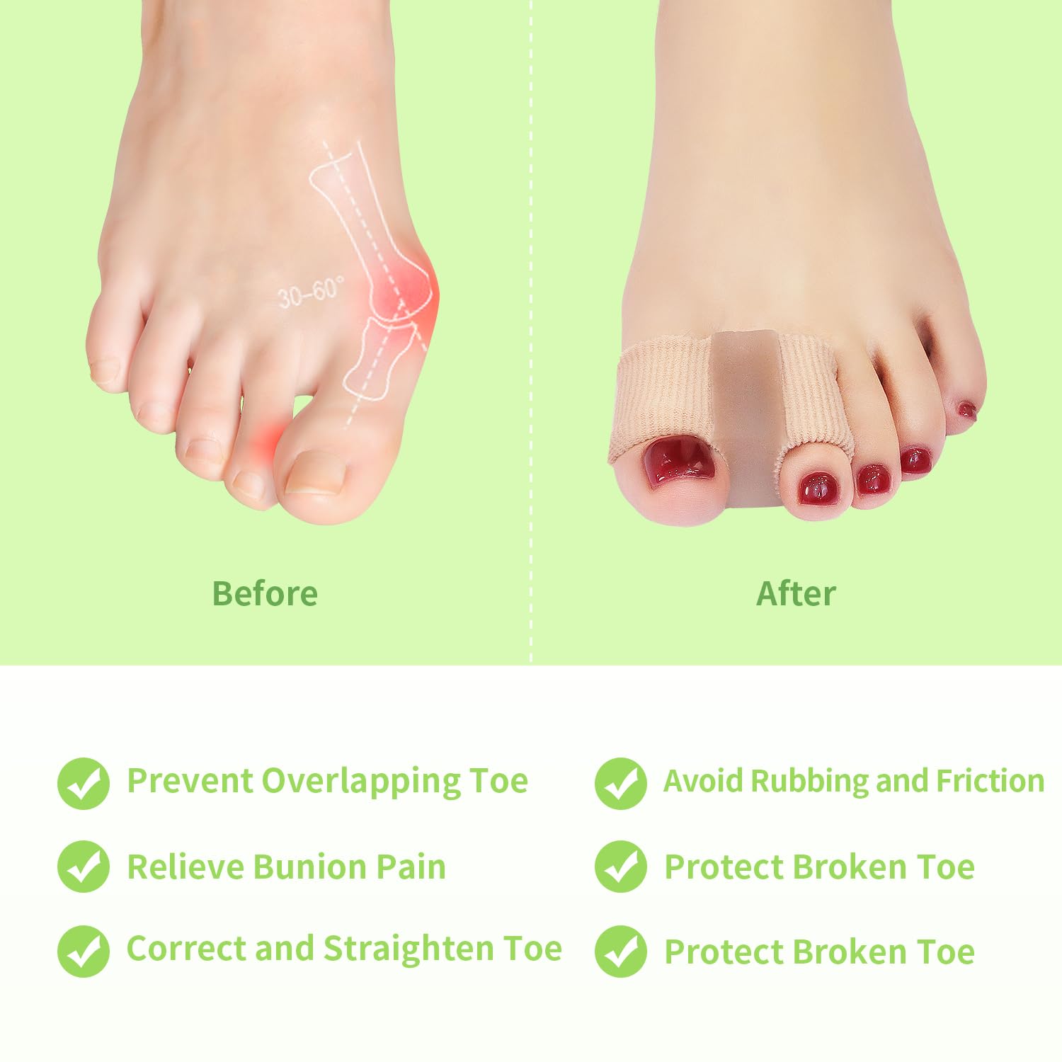 Niupiour toe corrector used for overlapping toes