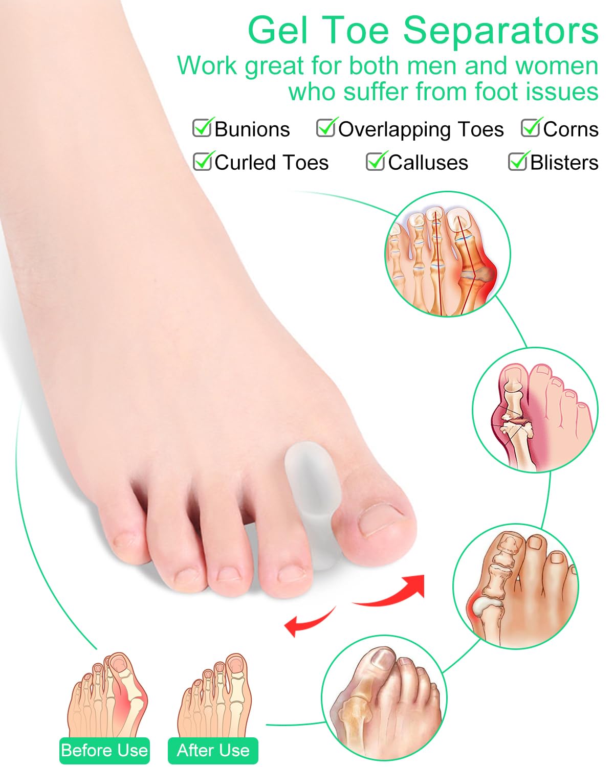 Close up of Pgrode toe alignment spacers showing flexibility