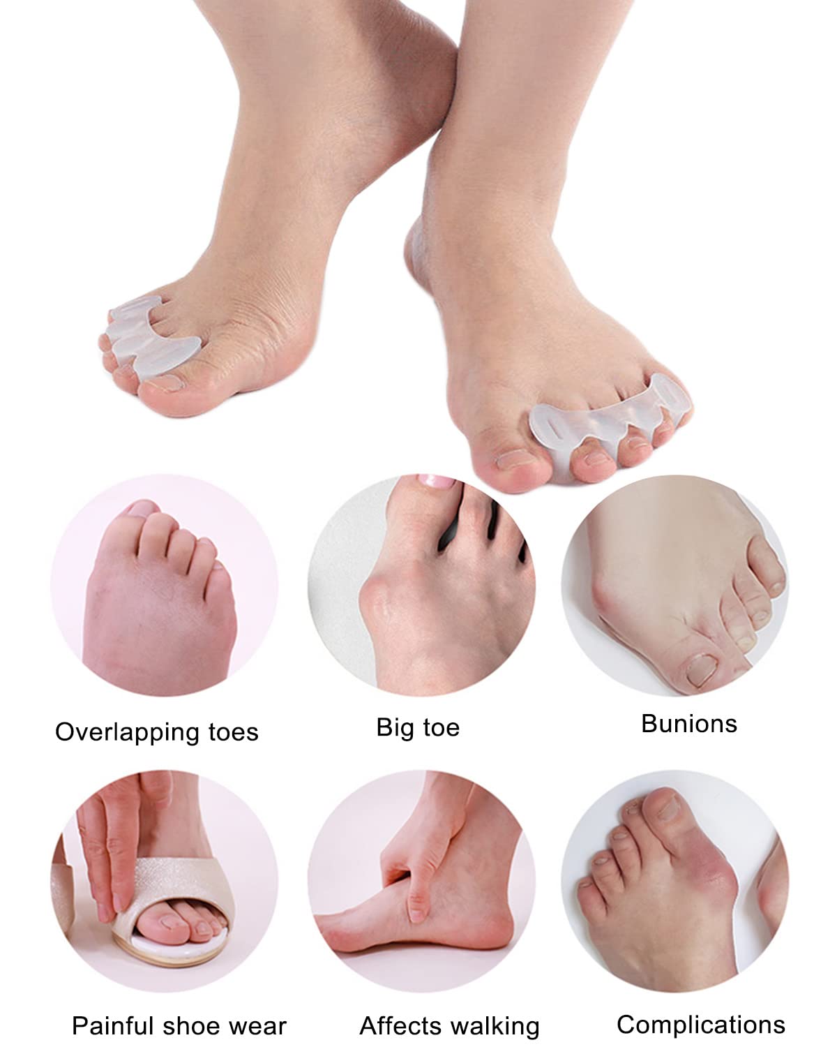 Golbylicc toe straighteners for natural alignment and pain relief