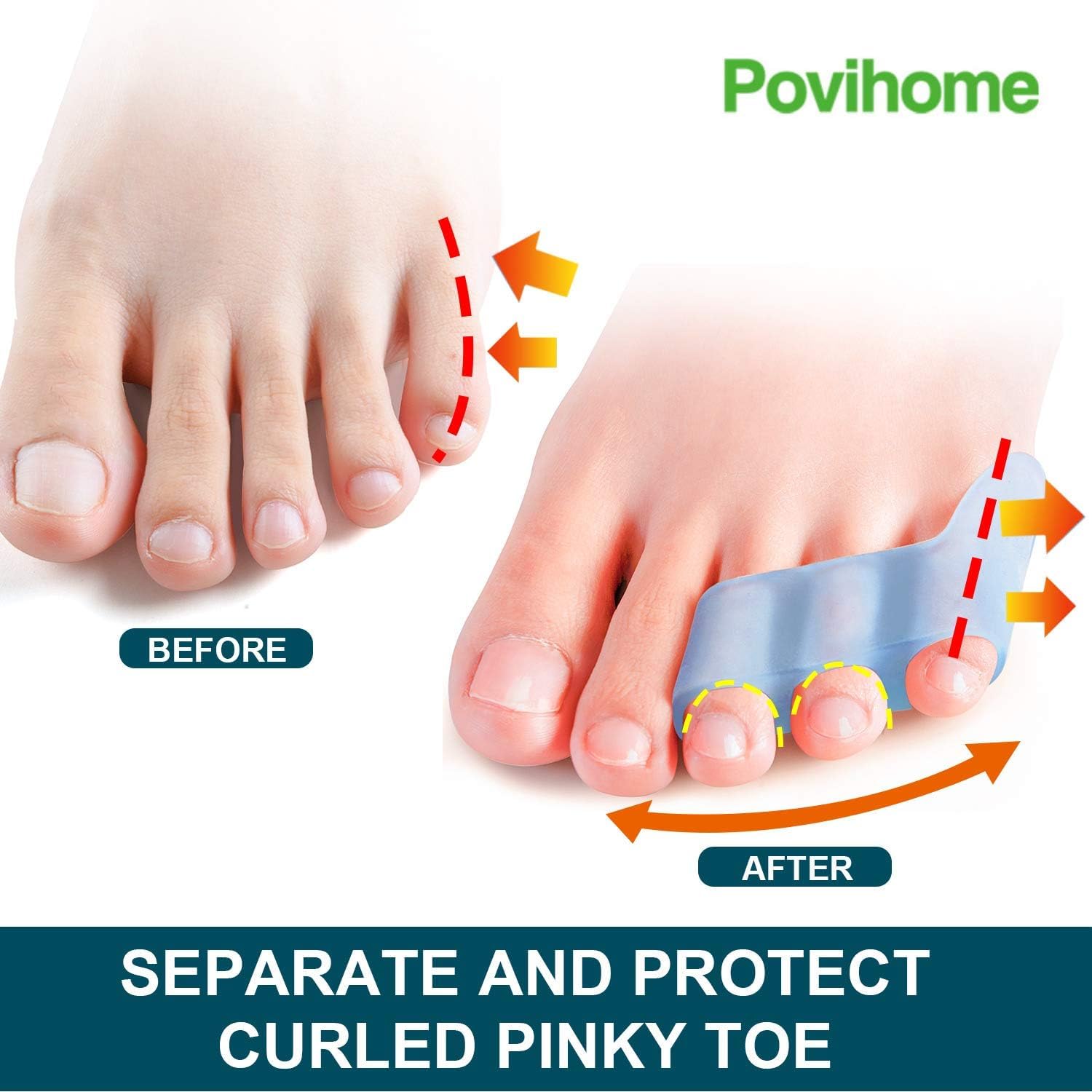 Close up of Povihome triple loop little toe cushion