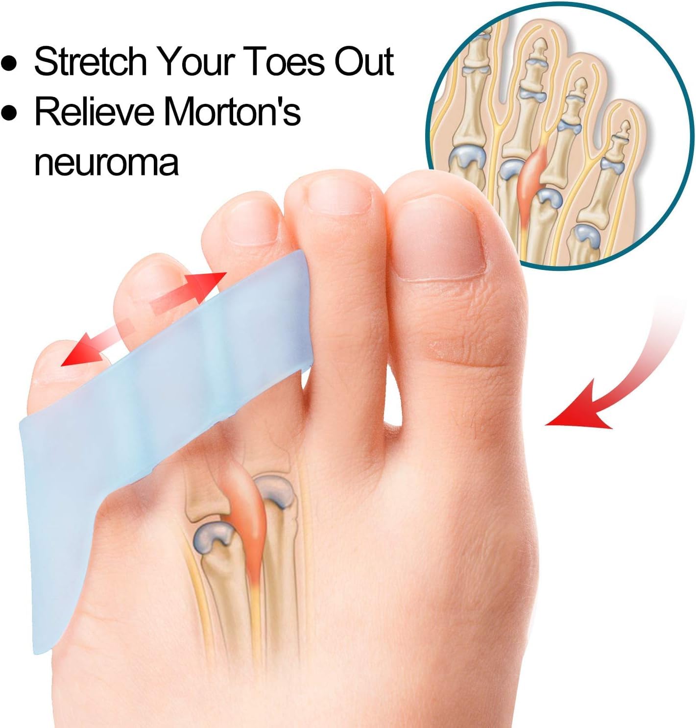 Povihome foot care gel spacers for Morton neuroma relief