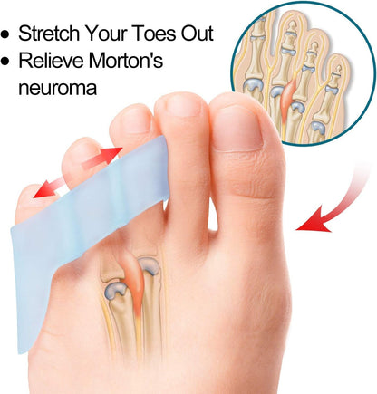 Povihome foot care gel spacers for Morton neuroma relief