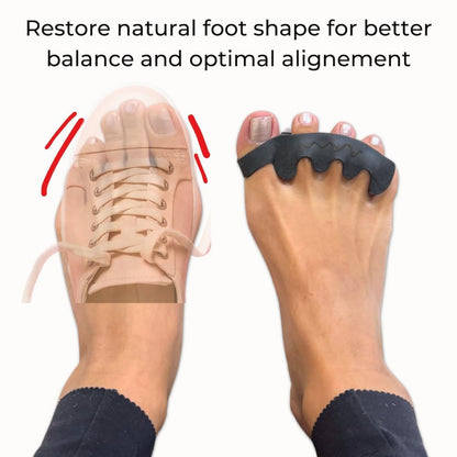 Side profile of black silicone 4-loop toe separator