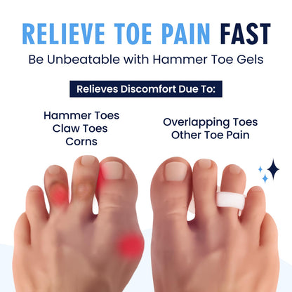 Two pairs of white hammer toe gel cushions on white background