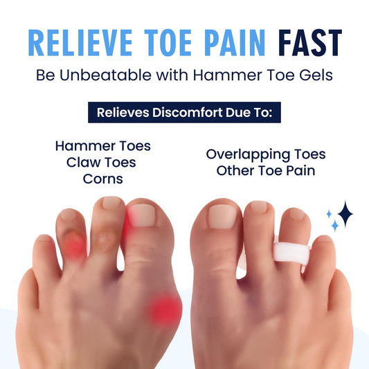 Two pairs of white hammer toe gel cushions on white background